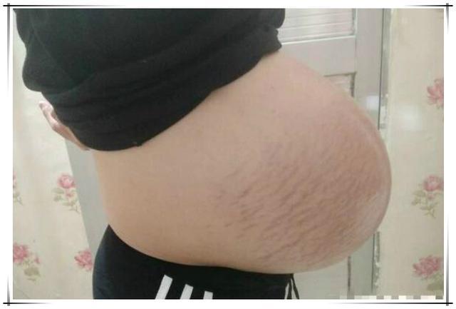 孕妇六个月肚子多大,孕妇六个月肚子大小详解